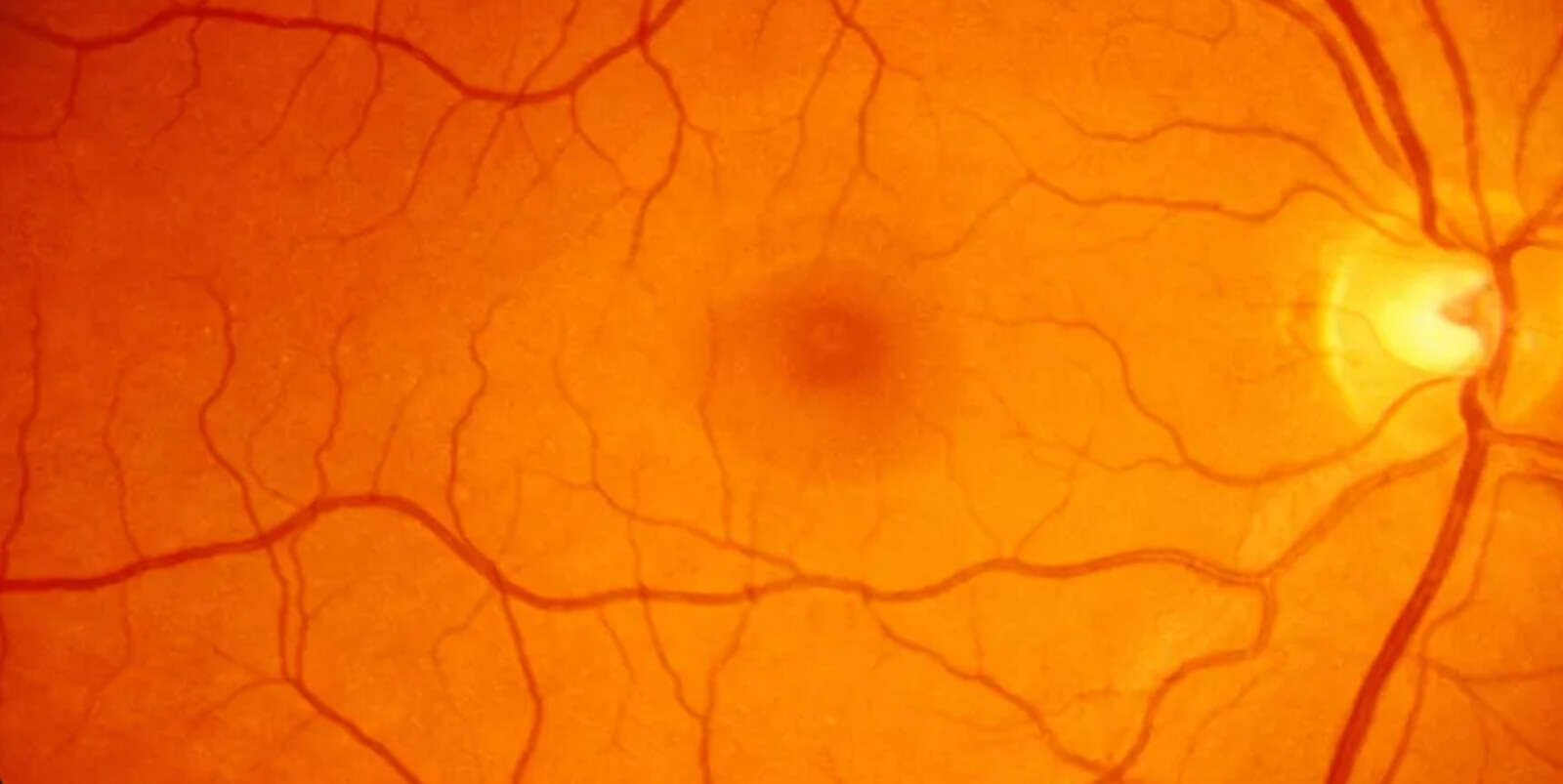 Centre for Vision Research