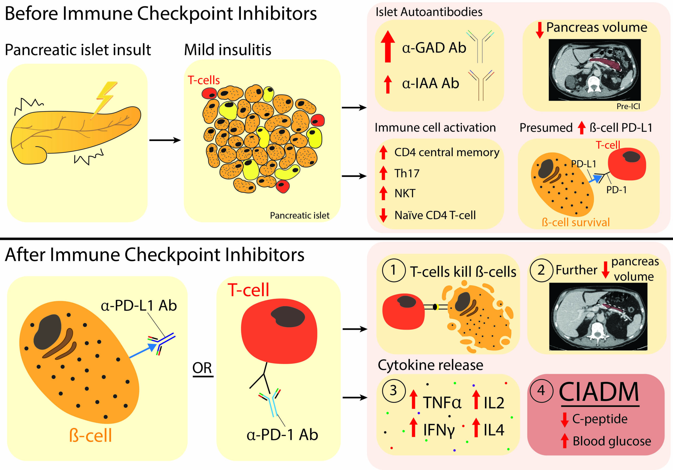 Predicting a rare but life-altering complication of common cancer treatment