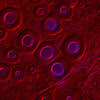 Researchers identify a key cellular pathway crucial for virulence of a killer fungus