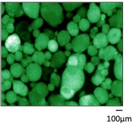 New research: Stem cells effective in treatment of type 1 diabetes