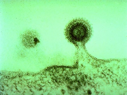 HIV cure research accelerated by breakthrough international agreement