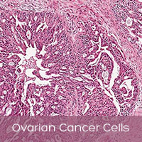 WMI researchers make advances in cancer research