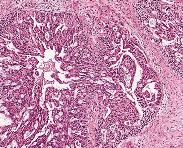 New funding brings hope to Western Sydney cancer patients