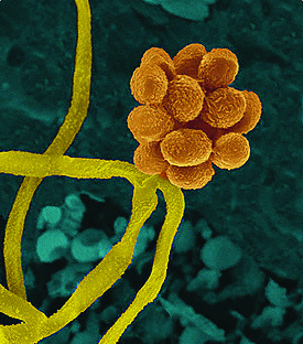 Multimillion dollar grant to boost Australia’s response to infectious disease outbreaks