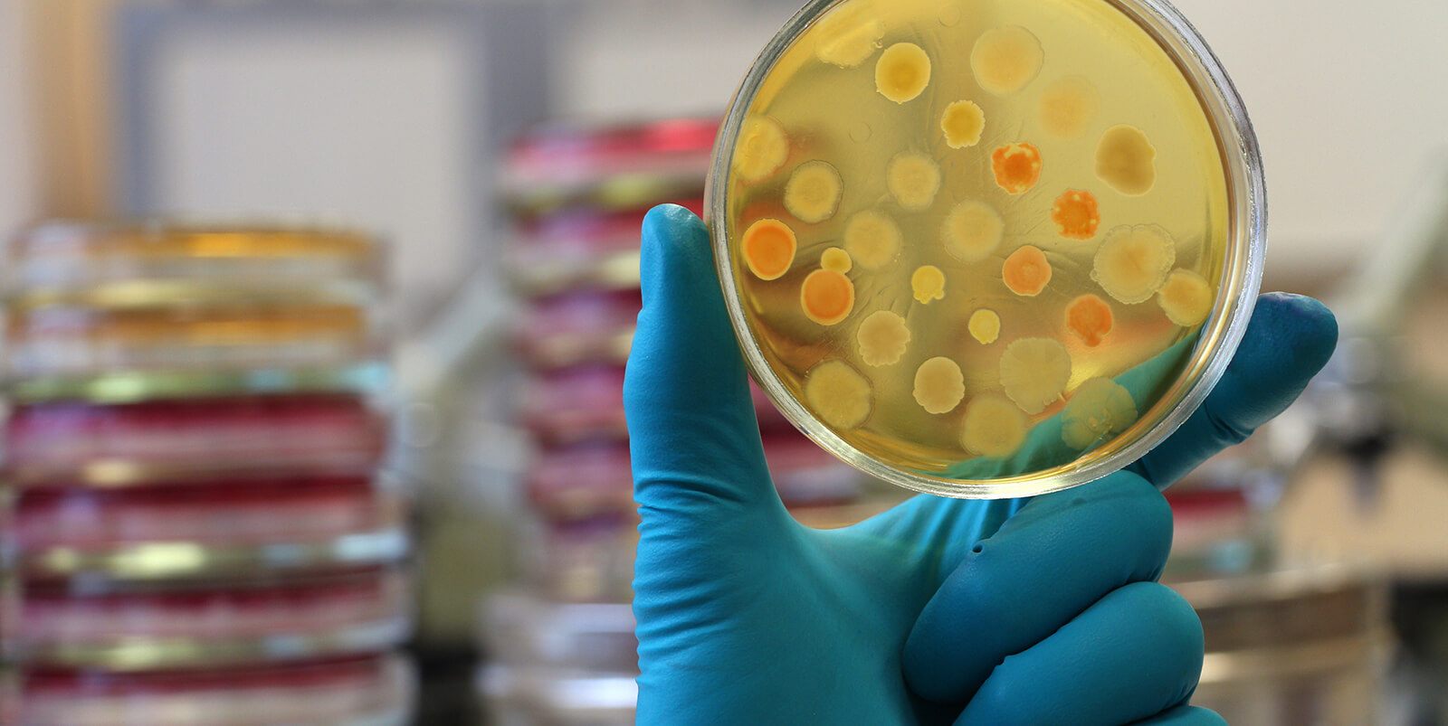 Plasmid therapy: A new approach to a global health threat